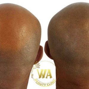 Wa-Beauty-Clinic-Gallery-01