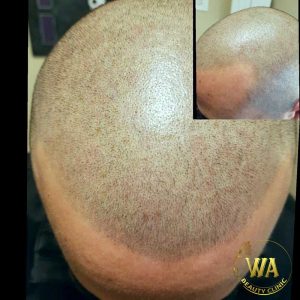 Wa-Beauty-Clinic-Gallery-02