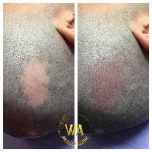 Wa-Beauty-Clinic-Gallery-04