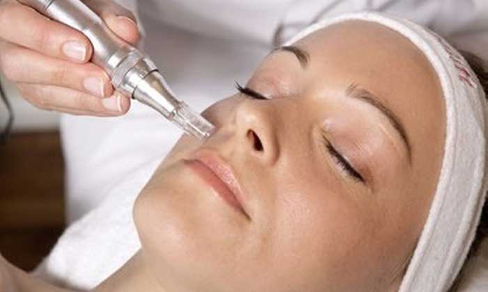 Nano-Infusion-Facial-Perth